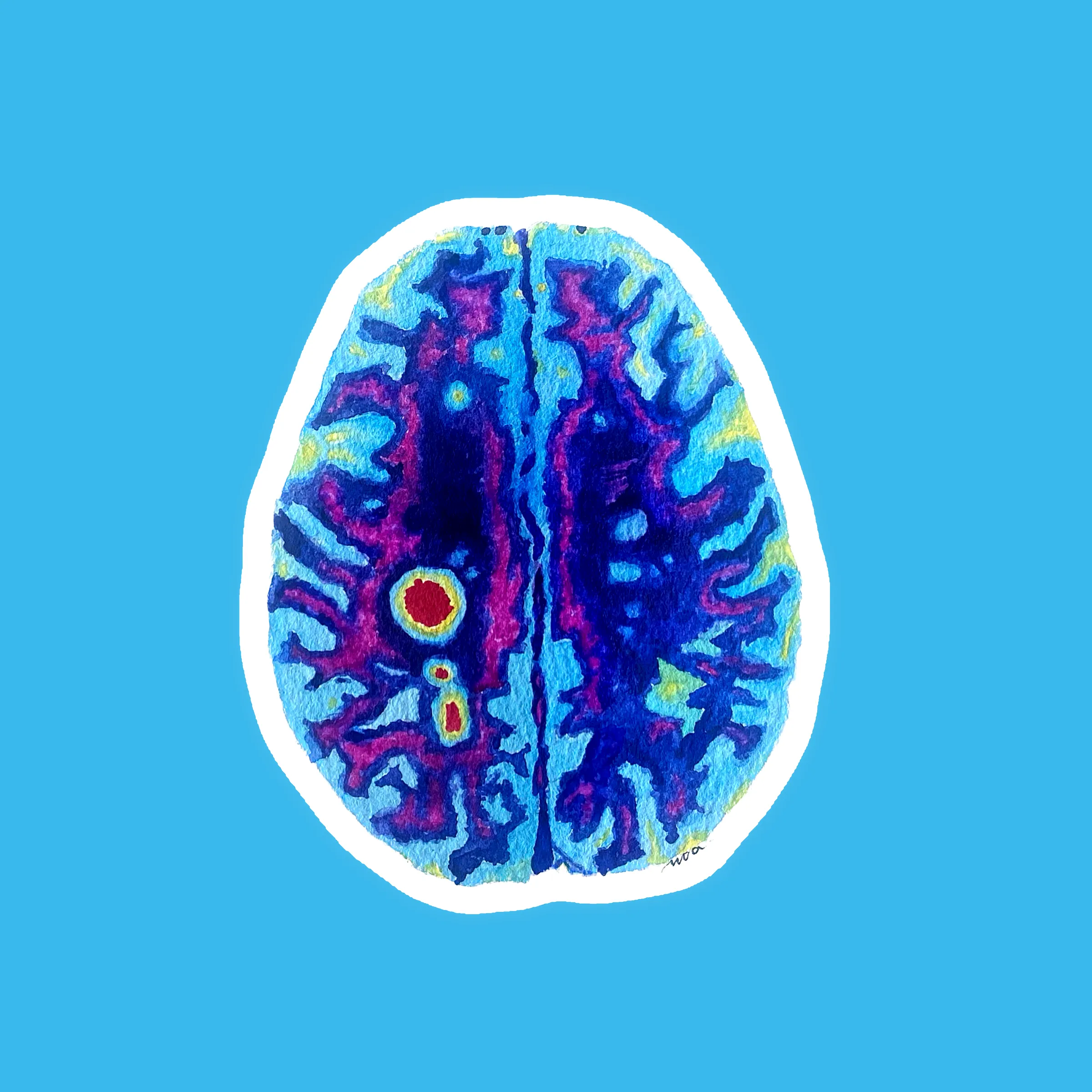 Coupe de cerveau colorée façon IRM, à l'aquarelle